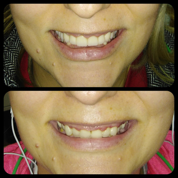 Slider image (5) Dr. Aleksandar Kovacevic - Dental Clinic in Croatia